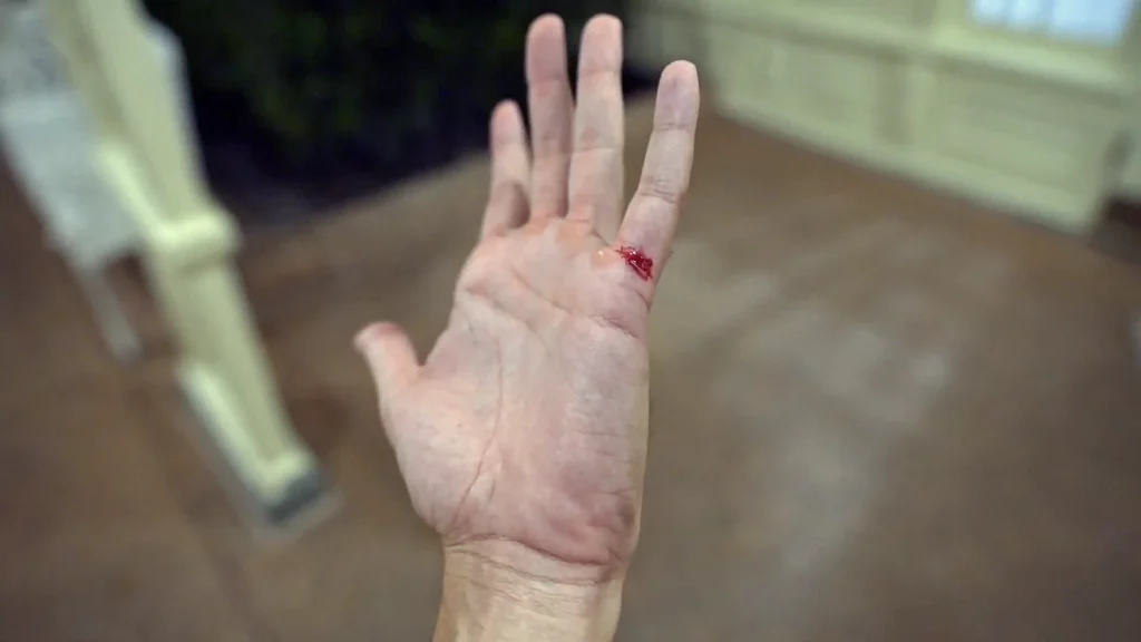 JoJo Crichton showing cut on his hand from the Sword in the Stone at Magic Kingdom